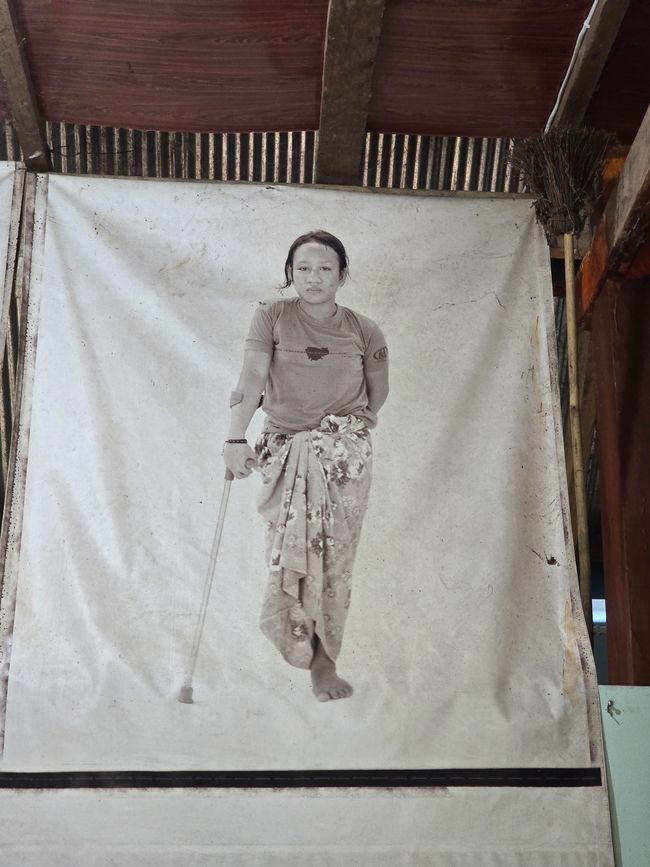 Aki Ra's Cambodia Landmine Museum