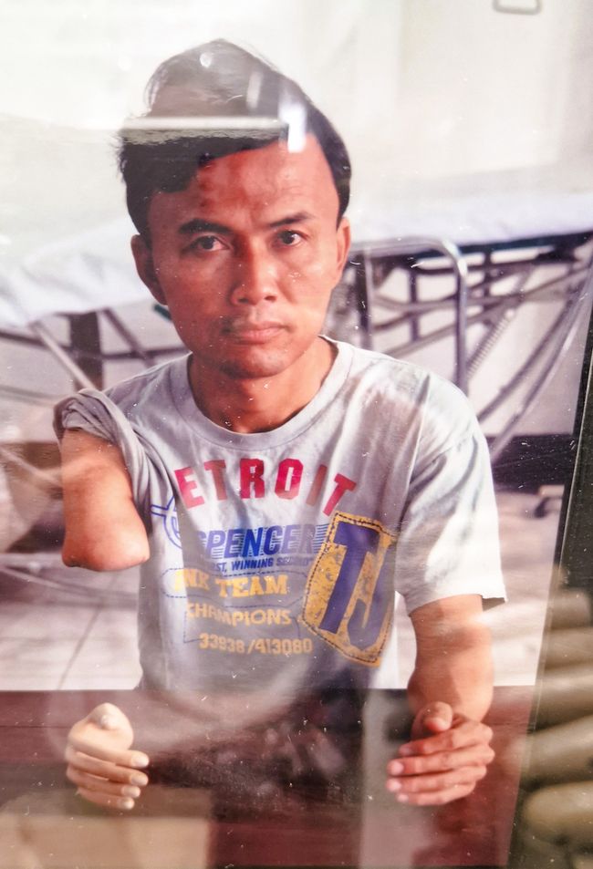 COPE - Cooperative Orthotic and Prosthetic Enterprise and our search for Laotian identity?