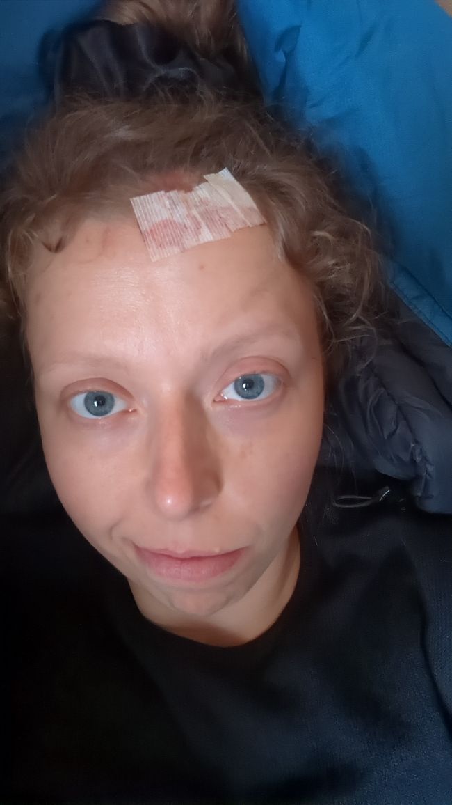 Am Camping Platz doch noch Steri Strips bekommen